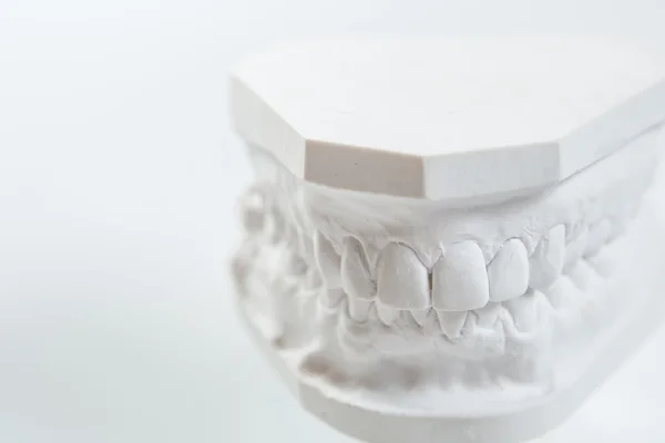 Гипсовая модель челюсти человека на белом фоне . — стоковое фото