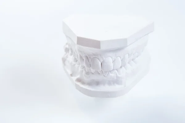 Gypsum model of human jaw on a white background. — Stock Photo, Image