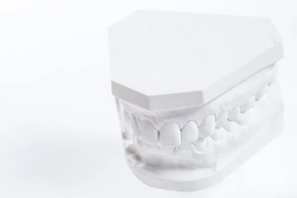 Gypsum model of human jaw on a white background. — Stock Photo, Image