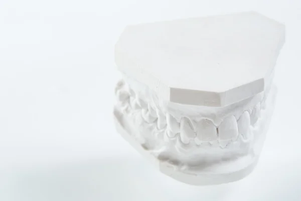 Modelul de gips al maxilarului uman pe un fundal alb . — Fotografie, imagine de stoc