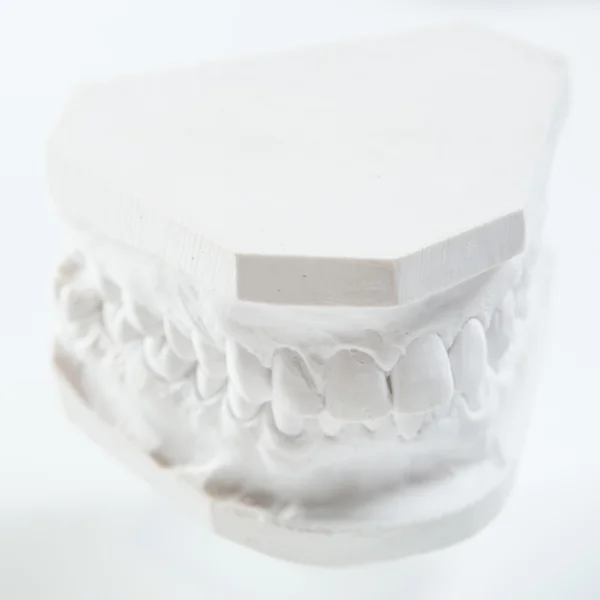 Modelo de gesso da mandíbula humana sobre um fundo branco . — Fotografia de Stock