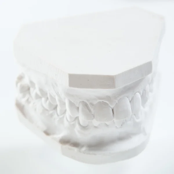 Gypsum model of human jaw on a white background. — Stock Photo, Image