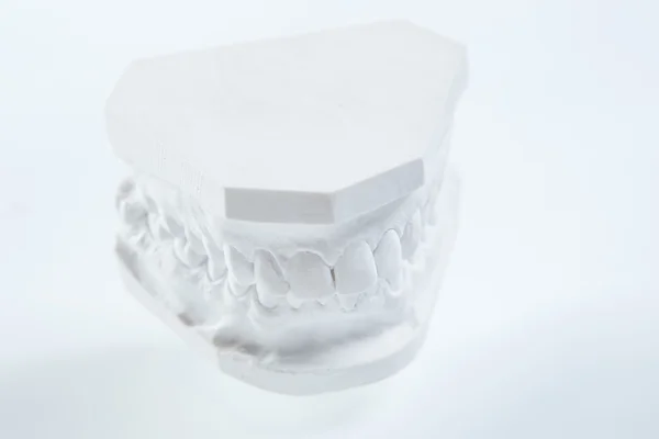 Gypsum model of human jaw on a white background. — Stock Photo, Image