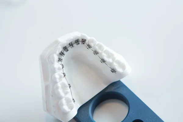 Dental lower jaw bracket braces model on white — Stock Photo, Image