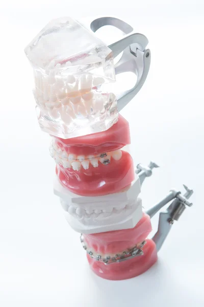 Dental model — Stock Photo, Image