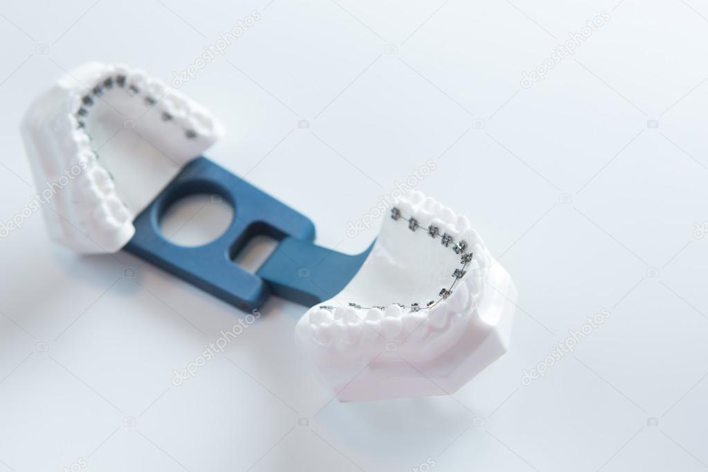 Dental lower jaw bracket braces model on white — Stock Photo