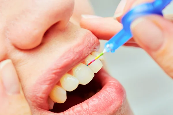 La correcta utilización de un cepillo de dientes para la higiene oral perfecta正确使用牙刷为完美的口腔卫生 — 图库照片