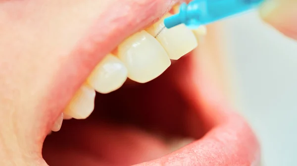 O uso correto de uma escova de dentes para uma higiene oral perfeita — Fotografia de Stock
