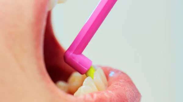 女性に彼女の歯を磨く方法を示す歯科医 — ストック写真