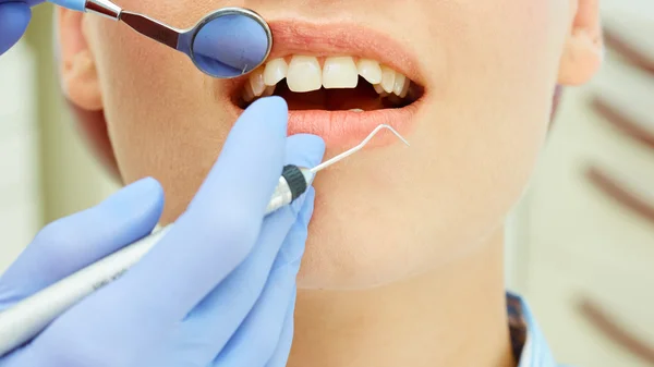 Examinar los dientes — Foto de Stock