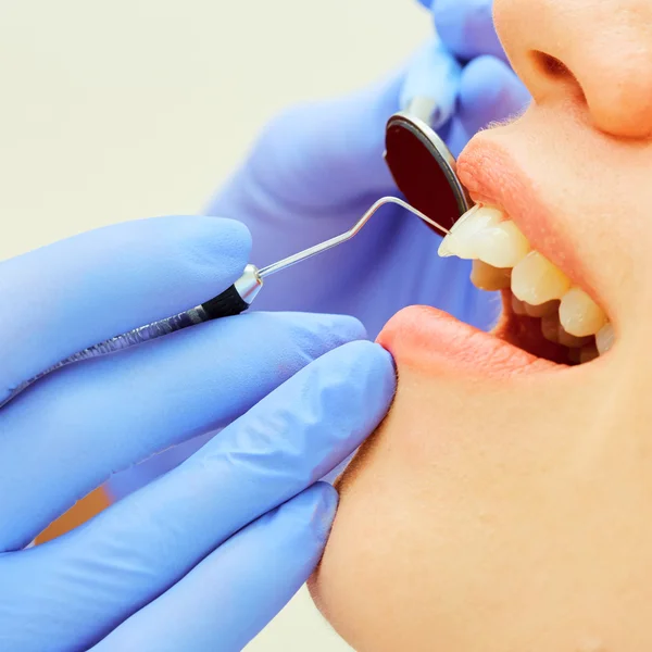 Examining teeth — Stock Photo, Image