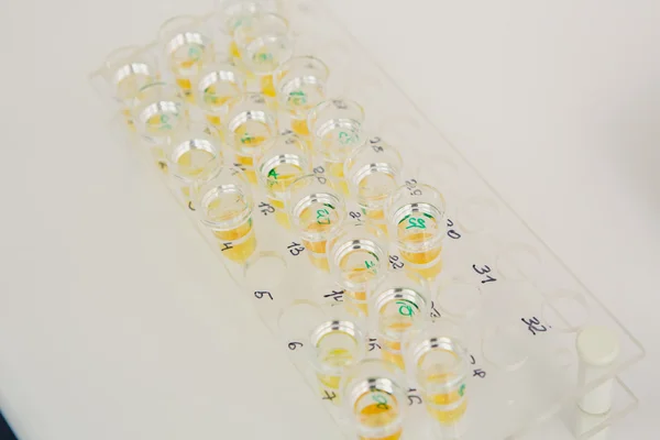 Lab tech loading samples into a chemistry analyzer — Stock Photo, Image