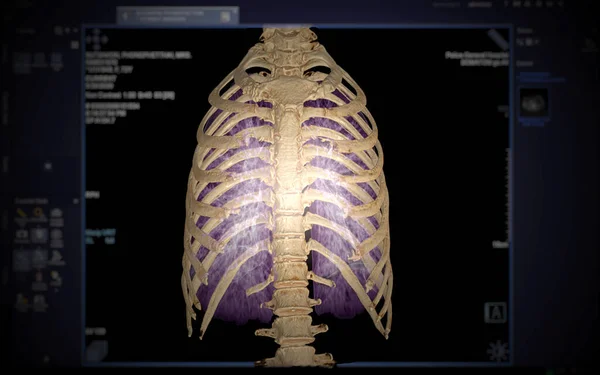 Ct背景下肺和胸围三维显示的胸部 — 图库照片