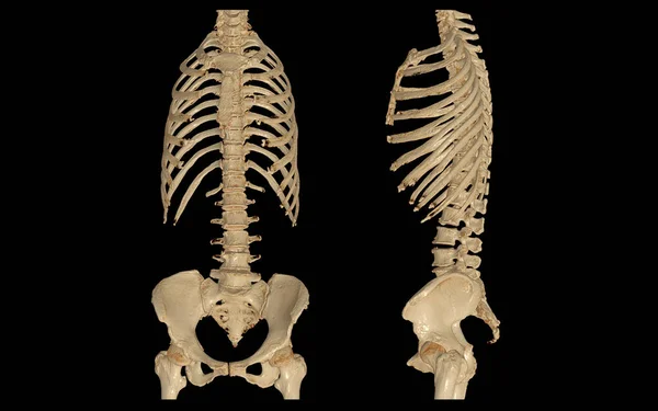 CT SCAN of Whole spine 3d rendering isolated on blurred monitor background. — Stock Image Scan Whole Spine Rendering Isolated Blurred Monitor Background Stock Picture