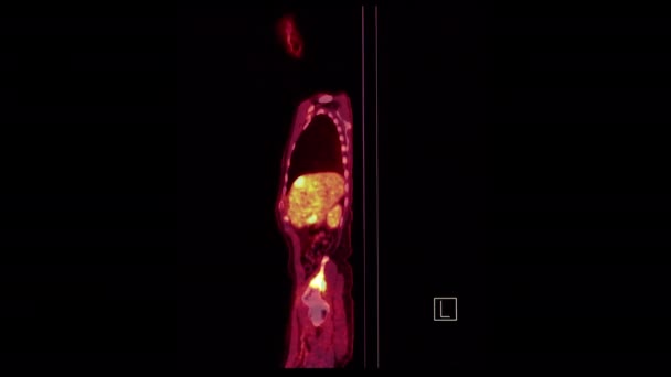 Pet Positron Emissziós Tomográfia Egész Emberi Test Renderelés Kép Piros — Stock videók