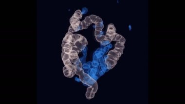 Tomografi 3D görüntüleme filmi kolorektal kanseri taramak için intra kolon gösteriyor. Kolon kanserinin taramasını kontrol et.