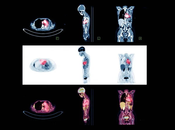 Pet Imagem Corpo Inteiro Comparação Plano Axial Coronal Sagital Para — Fotografia de Stock