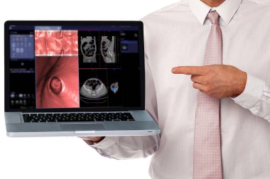 Doctor working with notebook showing CT colonography or CT Scan of Colon axial view vs Coronal view and 3D rendering image on the screen . Clipping path. clipart