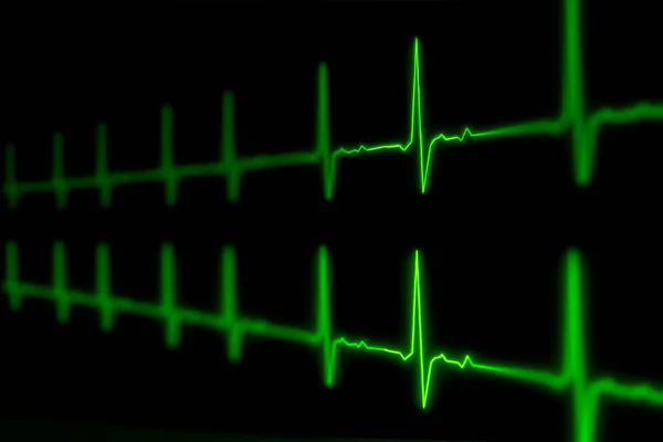 Ekg Eller Ekg Puls Hjärtslag Livstecken Grön Linje Illustration — Stockfoto