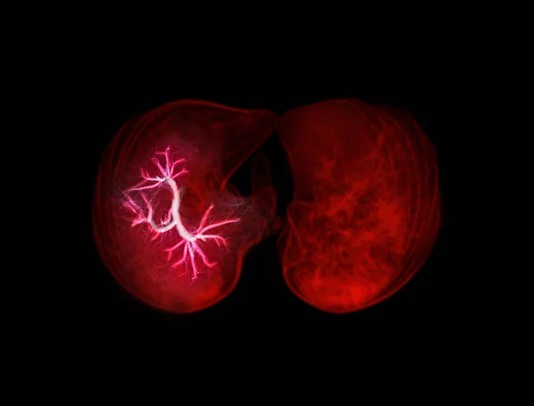 Вибірковий Фокус Грудної Клітки Або Lung Візуалізація Зображення Бутонів Діагностики — стокове фото