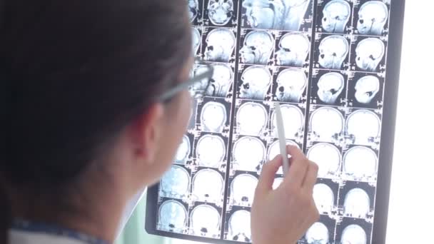 Doctor Looks at Brain MRI Scan — Stock Video