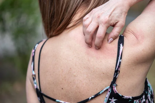 Mujer Con Picazón Rascarse Espalda —  Fotos de Stock