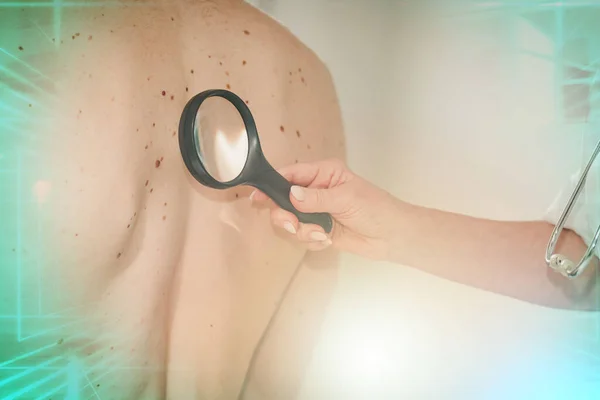 Dermatologis Memeriksa Kulit Bagian Belakang Pasien Beberapa Kali Terpapar — Stok Foto