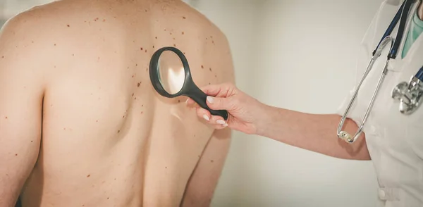 皮膚科医は患者の背中の皮膚を調べる — ストック写真