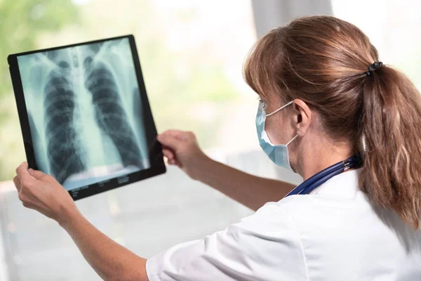 Ärztin Mit Medizinischer Gesichtsmaske Und Röntgenuntersuchung Der Lungen Bei Ausbruch — Stockfoto