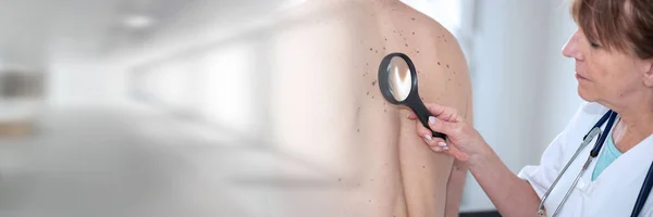 Dermatologe Untersucht Die Haut Auf Dem Rücken Eines Patienten Panorama — Stockfoto