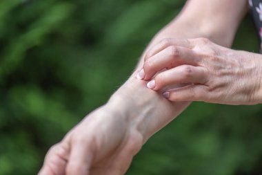 Kaşınan ve kolunu kaşıyan bir kadın.