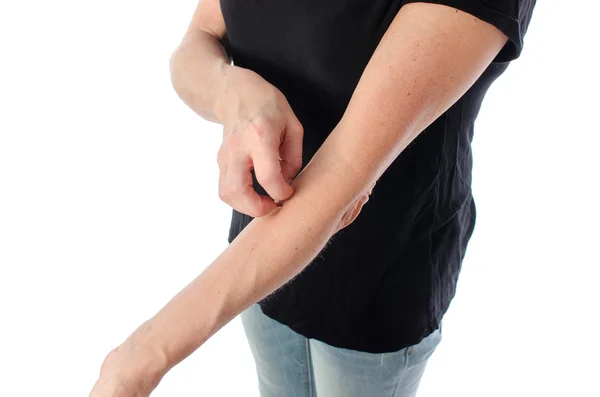 Mujer arañándose el brazo —  Fotos de Stock