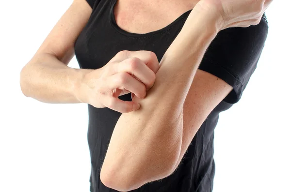 Woman scratching her arm — Stock Photo, Image