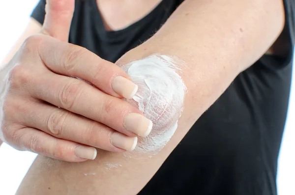 Mujer poniendo crema en su codo — Foto de Stock