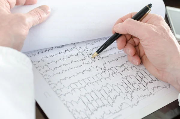 Médico analisando um eletrocardiograma — Fotografia de Stock