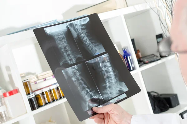 Läkaren tittar på en x-ray radiografi — Stockfoto