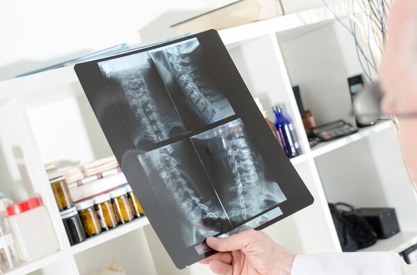 Doctor looking at a x-ray radiography