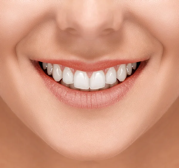 Healthy White Smile — Stock Photo, Image