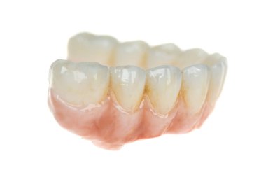 Diş sağlığı hizmetleri. Son versiyonda seramik zirkonyum. Zirkonyum oksit implantları üzerine diş protezini kapat, beyaza izole edilmiş. Yan görünüm