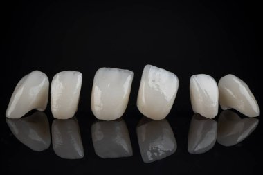 Siyah arka planda seramik takma dişler ve taçlar. Diş sağlığı hizmetleri. Son sürümde seramik zirkon.