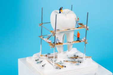 Moskova, Rusya - 9. Matra 2021: Bir insan dişi modeli ve etrafında küçük figürlerin yer aldığı bir sanat eseri. Diş yapılandırma, diş konsepti.