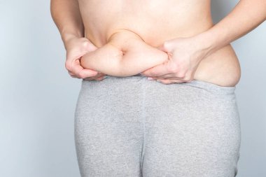 Kilolu ya da şişman yetişkin bir kadın. Gri arka planda göbeğini çok dar bir pantolonun içinde tutuyor. Sağlık, tıp konsepti.