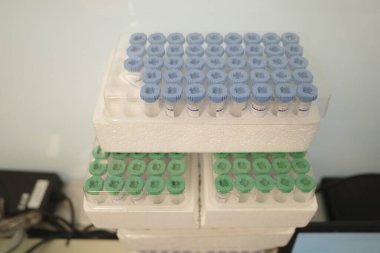 Laboratuvardaki numuneler için plastik tüpler.