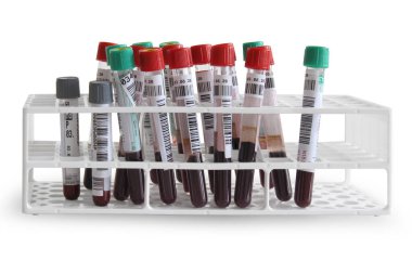 Beyaz arka planda kan olan test tüpleri