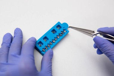 Diş muayenesi, diş teli sistemi, klinikte eklem makinesi.