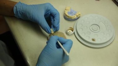 Diş teknisyeni laboratuardaki diş implantları için 3D baskı kalıbı üzerinde çalışıyor.