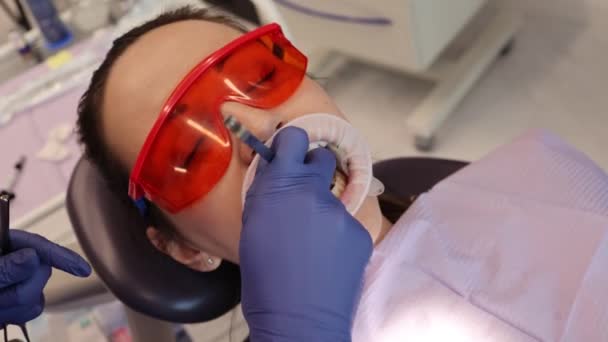 Установка брекетов у ортодонта, градусы, ортодонтия, вид сбоку — стоковое видео
