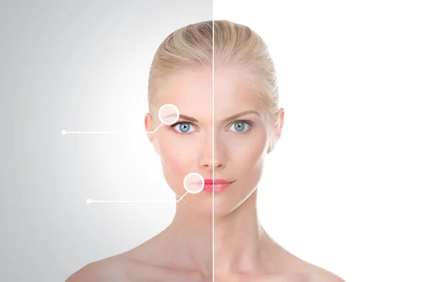 Tedavi öncesi ve sonrası İskandinav Güzellik