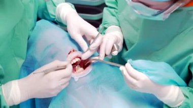 Diş cerrahlarından oluşan bir ekip bir dişe ameliyat yapıyor. Modern bir diş kliniğinde. Üst Manzara. Dişçiler ameliyattan önce hastanın dişlerini muayene ederler.. 