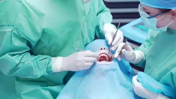 Fechar Uma Equipe Cirurgiões Dentistas Executa Cirurgia Dente Numa Clínica — Vídeo de Stock